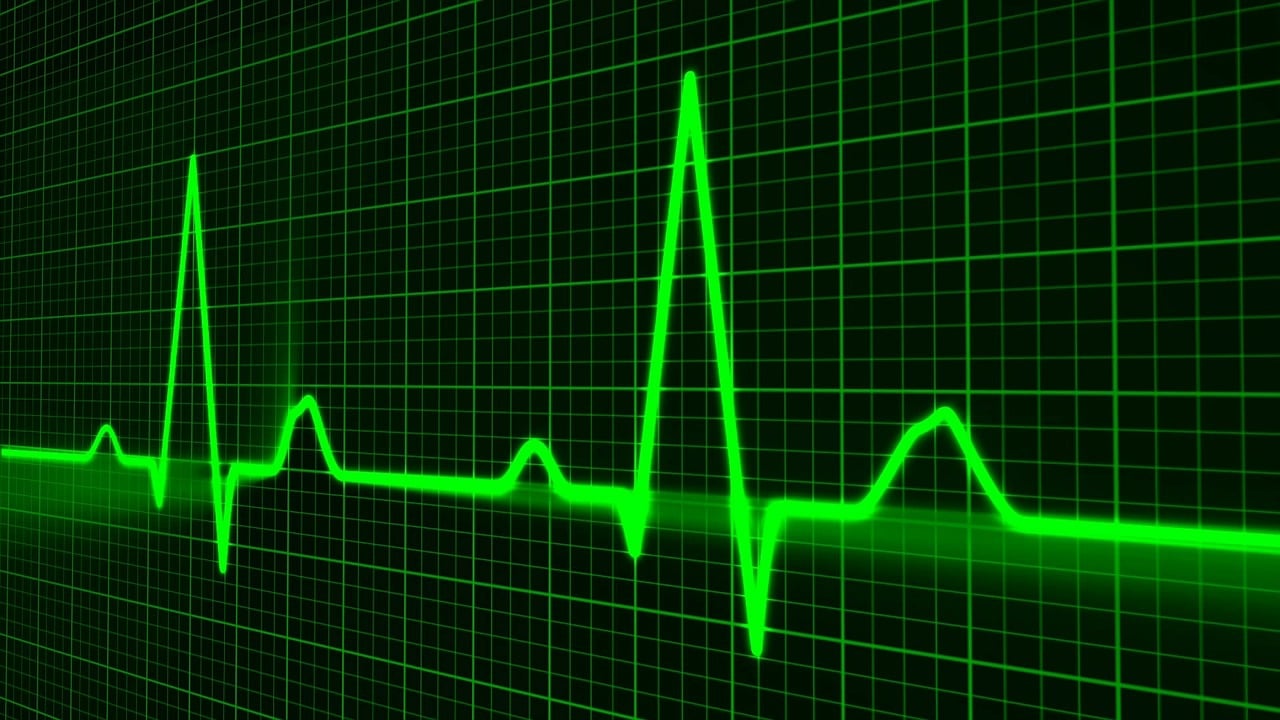 découvrez ce que sont les core web vitals, pourquoi elles sont essentielles pour le seo et l’expérience utilisateur, et comment améliorer la performance de votre site web grâce à ces indicateurs clés.
